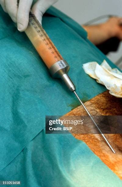 pictures of penisis|163 Penile Stock Photos & High.